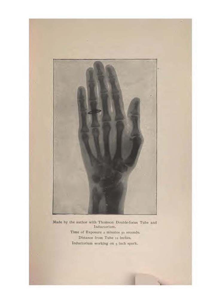 TheABCoftheXRays_Page_027