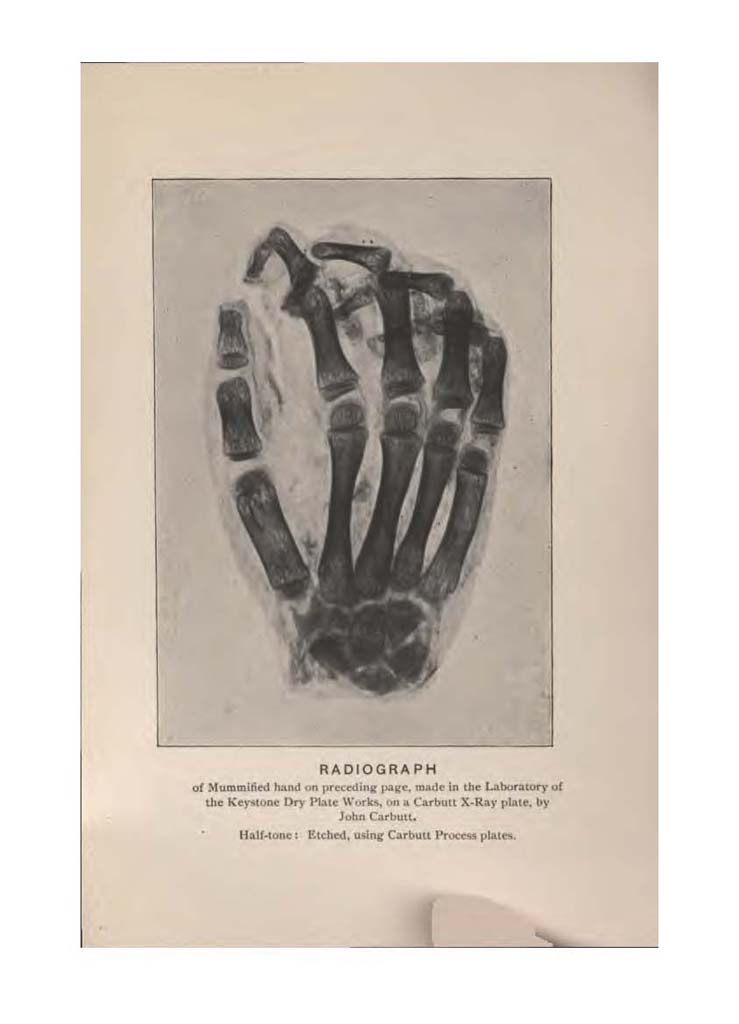 TheABCoftheXRays_Page_120