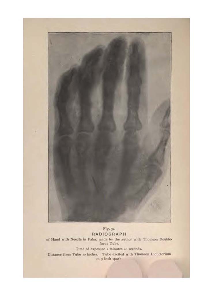 TheABCoftheXRays_Page_161
